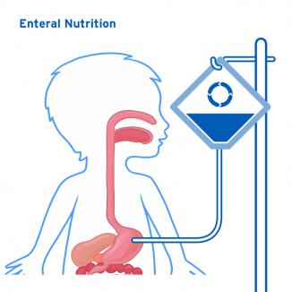 Enteral Nutrition